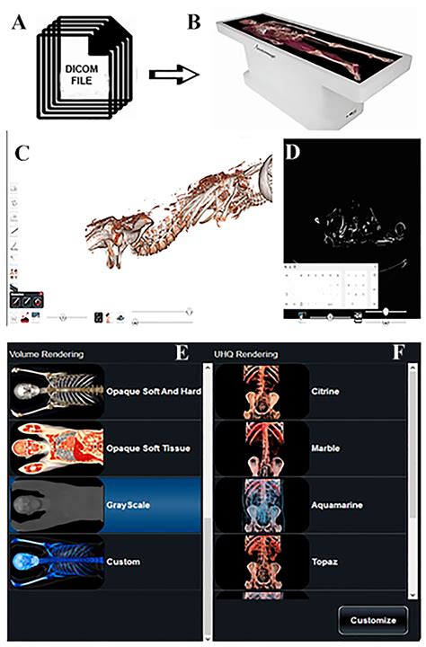 The Role of 3D Virtual Anatomy and Scanning Environmental Electron ...