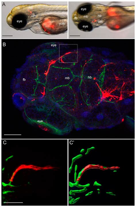 Compromised Blood-Brain Barrier Junctions Enhance Melanoma Cell ...