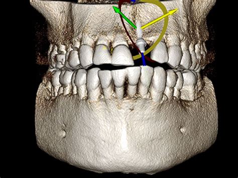 Snaap CBCT - Best CBCT Centre in Surat - Athwa Gate - Professional Cone ...