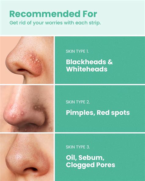 How To Get Rid Of Pimples On Nose