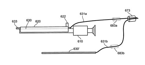 Apparatus and method for thermal ablation of uterine fibroids - Eureka | Patsnap