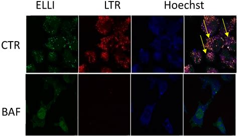 Drug Sequestration in Lysosomes as One of the Mechanisms of ...