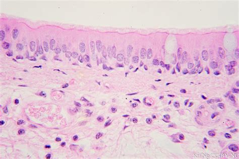 Pseudostratified Columnar Epithelium – Kit Ng, Ph.D.