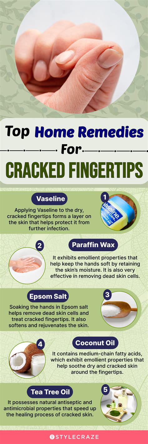 How To Heal Painful And Cracked Skin On The Fingertips At Home
