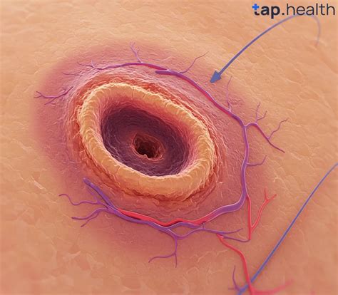 What Vitamins Help Wound Healing? A Comprehensive Guide