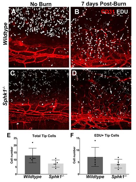 Ablation of Sphingosine Kinase 1 Protects Cornea from ...