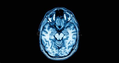 Image result for Body Parts Scan