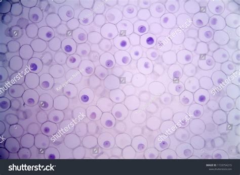Mitosis Animal Cell Under Microscope Stock Photo (Edit Now) 1133754215