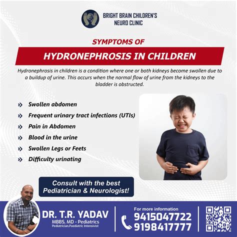 Symptoms of Hydronephrosis in Children | Dr. T R Yadav