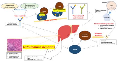 Vaccine-Related Autoimmune Hepatitis: Emerging Association with SARS-CoV-2 Vaccination or ...
