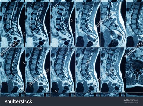 769 Back Ct Scan Stock Photos, Images & Photography | Shutterstock