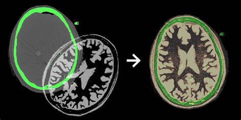 Image result for High Quality Image Registration Software