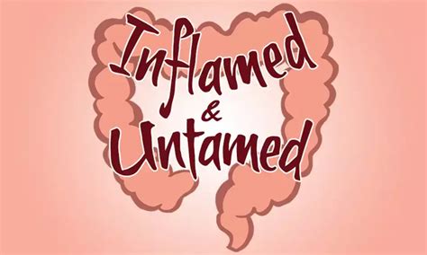 Serum oncostatin M, a potential biomarker of disease activity and ...