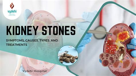 Kidney Stones: Symptoms, Causes, Types, and Treatments