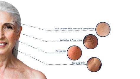 Aging Sign 的图像结果