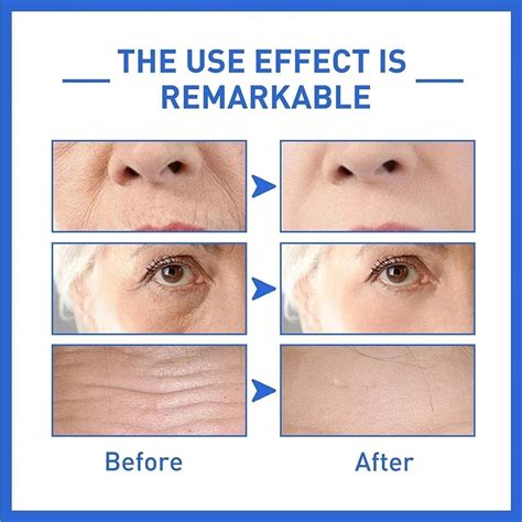 Anti Ageing Face Serum Retinol For Skin