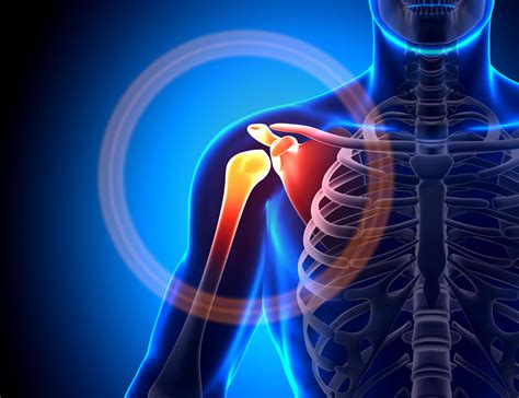 Common Shoulder Injuries - Nebraska Orthopaedic Center
