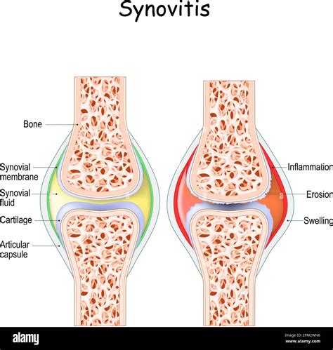 Synovial Membrane Diagram