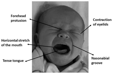Application of Texture Descriptors to Facial Emotion Recognition in Infants