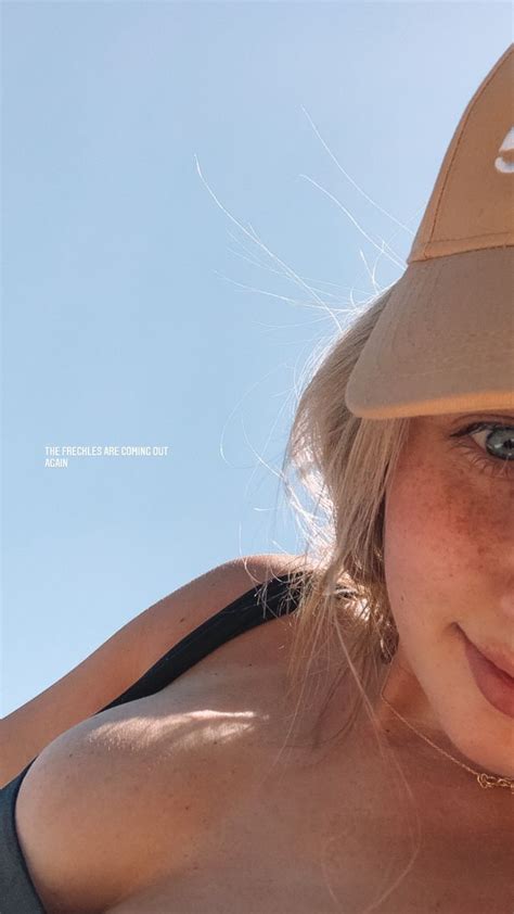 Image result for Freckles Using Self Tan