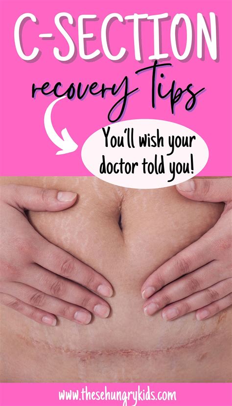 9 c section recovery tips to help you heal quickly – Artofit