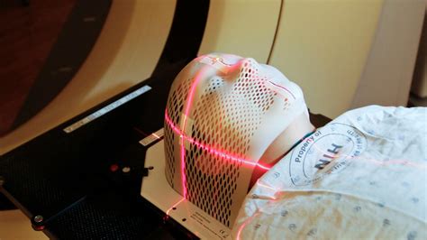 About SPArc Therapy Treats Cancer: UPSC Current Affairs