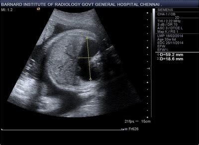 BIR CoW 19 April 2015