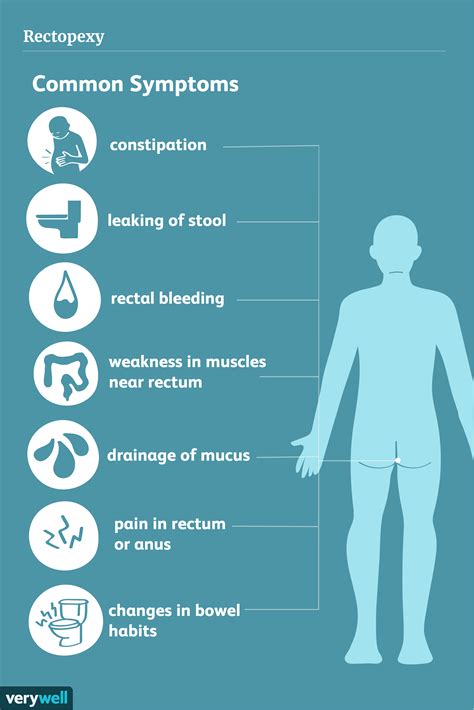 Rectal Prolapse Signs, Diagnosis, and Treatment