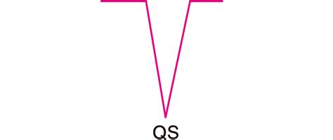 QRS波の高さを見る|心疾患の心電図（2） | 看護roo![カンゴルー]