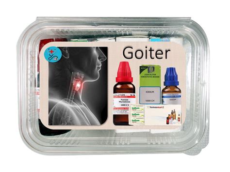 Goiter treatment homeopathy medicines for swelling around neck – Homeomart