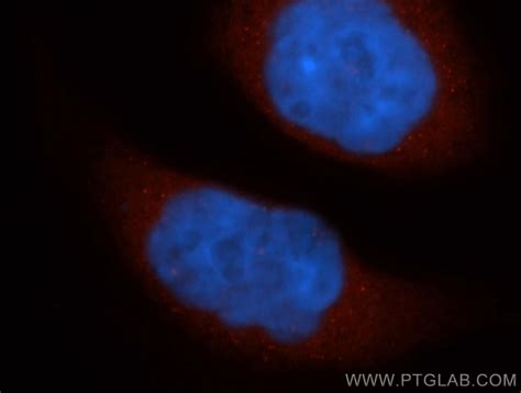 CTMP antibody (14692-1-AP) | Proteintech