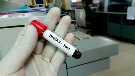 What are the Symptoms of Low DHEA (Dehydroepiandrosterone)? – NutritionFact.in