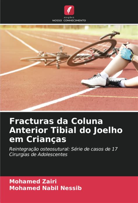 Buy Fracturas da Coluna Anterior Tibial do Joelho em Crianças ...