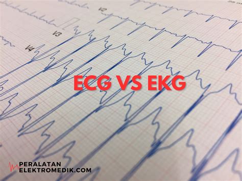 ECG vs EKG (Electrocardiograms)