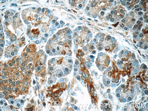SERPINB10 antibody (21719-1-AP) | Proteintech