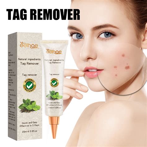 Mole Elimination Cream Moles Tag Removal Gram Warts Ointment Hands Feet Face Armpits Flesh Neck ...