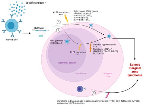New Insights into the Biology and Diagnosis of Splenic Marginal Zone Lymphomas