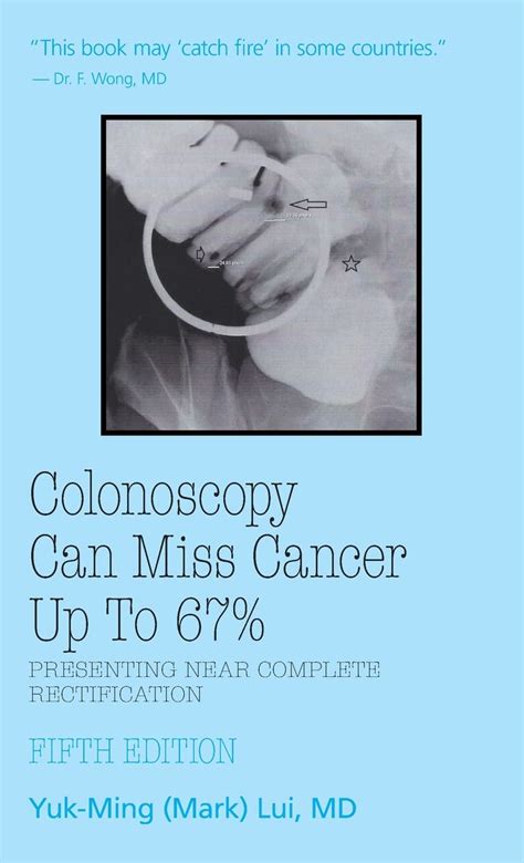 Buy Colonoscopy: Can Miss Cancer Up to 67%_Presenting Near Complete ...