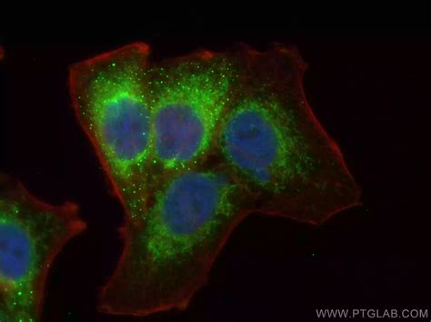 Mitochondria Antibodies | Proteintech Group