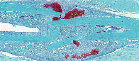 Bone or cartilage: how stem cells repair bone fractures | Harvard Stem ...