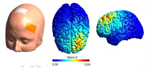 Image result for Dorsolateral Prefrontal Cortex