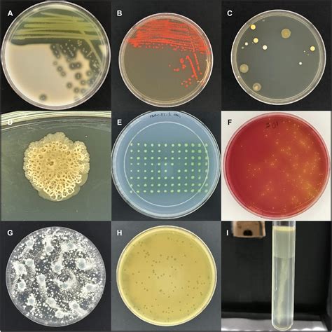 Petri Dish With Agar