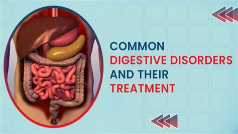 Common Digestive Disorders 的图像结果