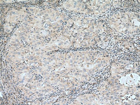 IL-24 antibody (12064-1-AP) | Proteintech