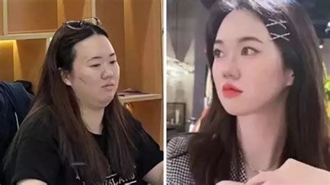 Overwork Obesity: Chinese Woman Gained 20 Kilos Due To Work Stress; 4 ...