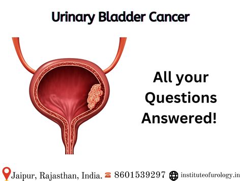 Bladder Cancer 的图像结果
