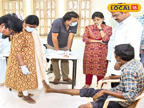 Sadaram Certificate: దివ్యాంగులకు శుభవార్త! రేపటి నుంచే సదరం క్యాంపులు ...