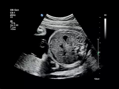 Philips - Affiniti 70 - Circular Edition refurbished ultrasound system