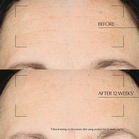 Advanced Night Repair Overnight Treatment | Estée Lauder