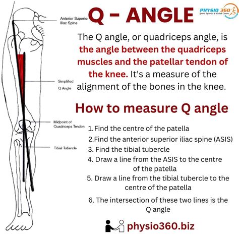 What is Q Angle and How to Measure It? | Physio360Chennai posted on the topic | LinkedIn